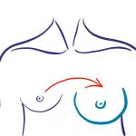 Breast augment icon 2