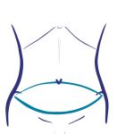 abdominoplasty icon