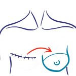 breast reconstruction icon